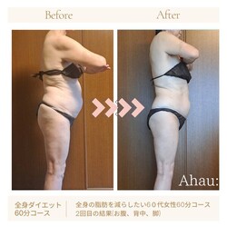 ダイエットコース全身60分|Ahau:diet slimming salon