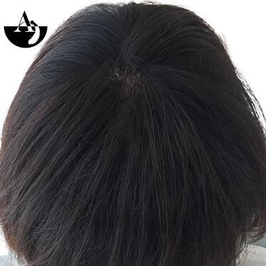 エアエク® ビフォーアフター③|hair create MUSE