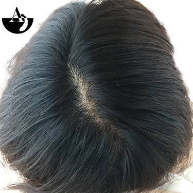 エアエク® ビフォーアフター③|hair create MUSE