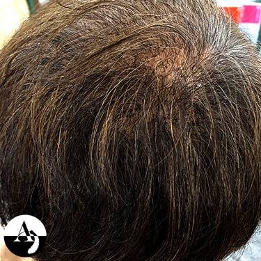 エアエク® ビフォーアフター④|hair create MUSE