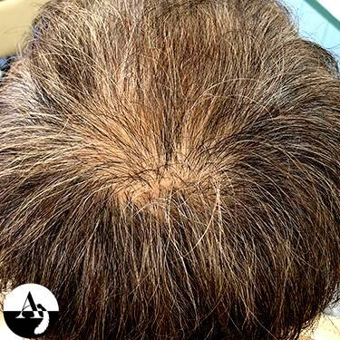 エアエク® ビフォーアフター④|hair create MUSE