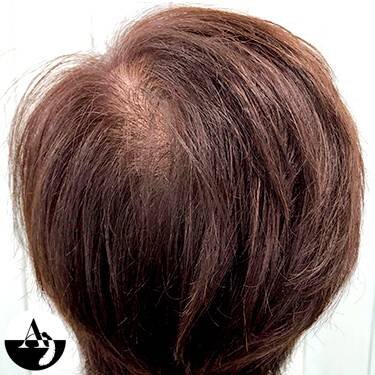 エアエク® ビフォーアフター②|hair create MUSE