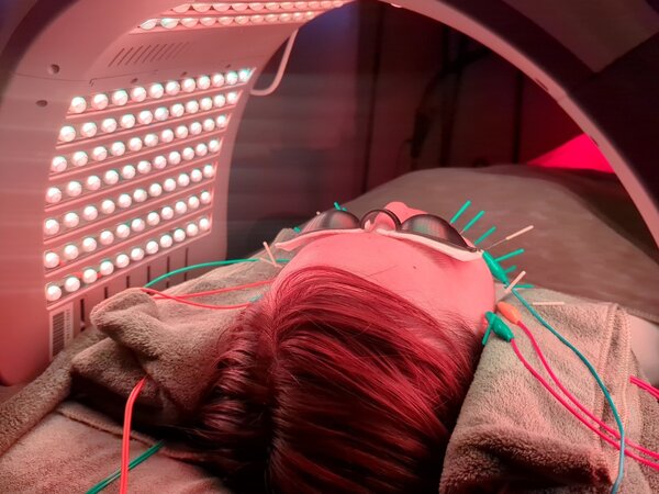 【エラ張り強制終了】エラ特化美容鍼+小顔LED+顔幅矯正|美容とカラダの鍼灸サロン やなけん 亀戸店