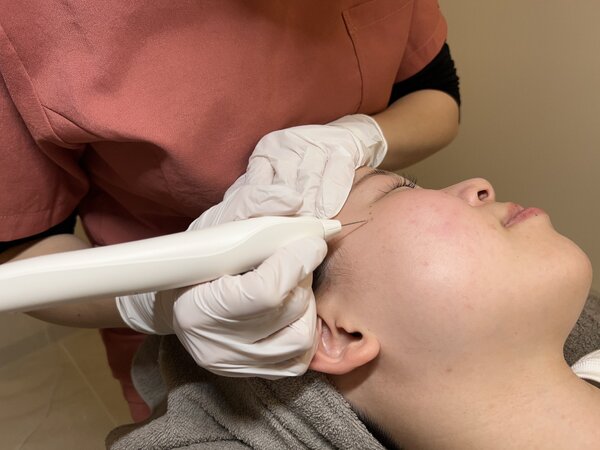 プラズマ・シミケア|nap.