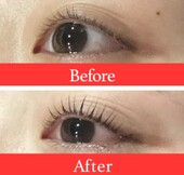 【まつ毛パーマ】ビフォーアフター①|ビューティーサロンshin