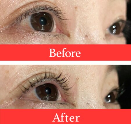 【まつ毛パーマ】ビフォーアフター②|ビューティーサロンshin