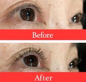 【まつ毛パーマ】ビフォーアフター②|ビューティーサロンshin