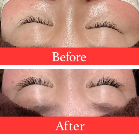 【マツエク】ビフォーアフター①|ビューティーサロンshin