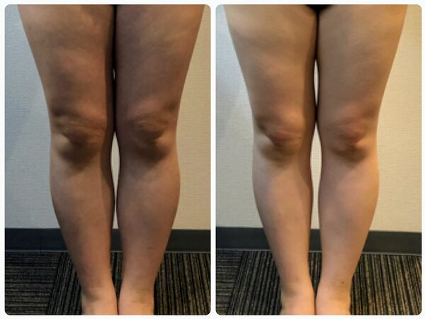  美脚ケア/太ももスッキリ|Beautysalon REFLET