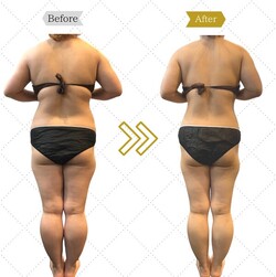 神技サイズダウン|Beautysalon REFLET