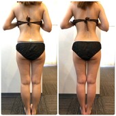 ブライダルエステ|Beautysalon REFLET