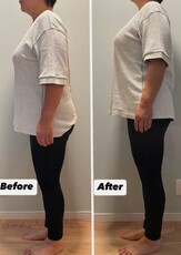 【骨盤彫刻術®～美子宮デザイン～】ビフォーアフター①|will B...?