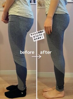 【骨盤彫刻術®～美子宮デザイン～】ビフォーアフター②|will B...?