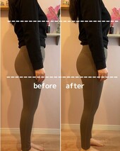 【骨盤彫刻術®～美子宮デザイン～】ビフォーアフター③|will B...?