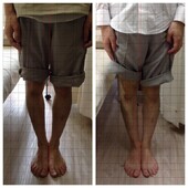 膝下のねじれ解消|ひだまり整体院