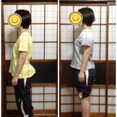 姿勢矯正・骨盤矯正|ひだまり整体院