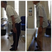 約2週間、5回の施術での比較|ひだまり整体院