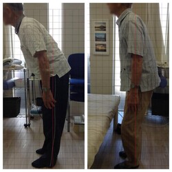 約2週間、5回の施術での比較