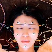 【お悩み別美容鍼】オーダーメイド美容鍼灸|さつき鍼灸整骨院 鍼灸フェイシャルサロンさつき