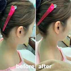 【お顔そり】before/after①|おしゃれサロンささ