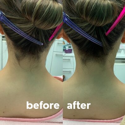 【お顔そり】before/after②|おしゃれサロンささ