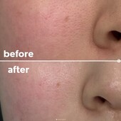 【水エステ】before/after②|おしゃれサロンささ