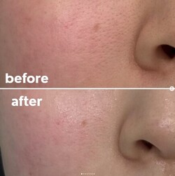 【水エステ】before/after②|おしゃれサロンささ