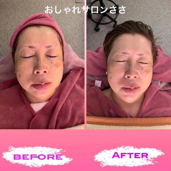 【‬温活エステ】before/after|おしゃれサロンささ