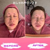 【‬温活エステ】before/after|おしゃれサロンささ