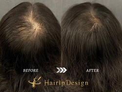 ヘアタトゥー（Before After）女性②