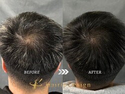 ヘアタトゥー（Before After）男性②