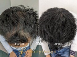 ヘアタトゥー（Before After）男性①