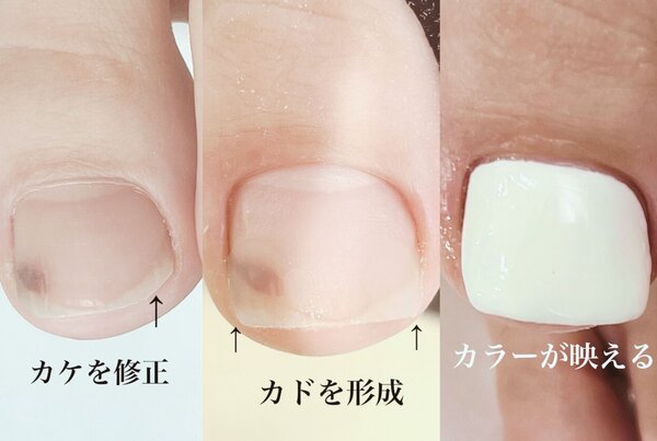 「フット ワンカラー」爪形成は+¥1500でできます。 しっかりとケアし、カドを作ることでより美しい仕上がりになります！|Nail Salon Linda