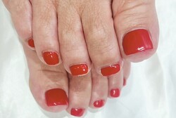 「フットケア＋爪形成＋足裏ケア」深爪や欠けた爪を形成し、美しい仕上がりになる爪形成です|Nail Salon Linda