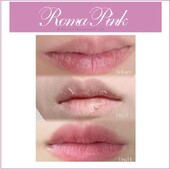 【ローマピンク】モニター価格実施中！|医療提携サロンYAE C5 CLINIC