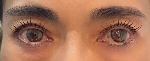 まつげカール③