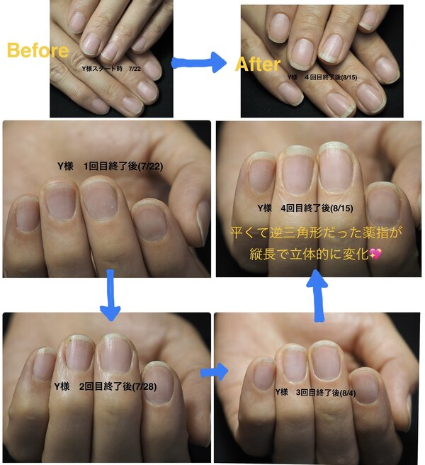スタイル写真⑫： ネイルケア自爪育成（3回コース）¥18,150|ネイルサロン Be happy