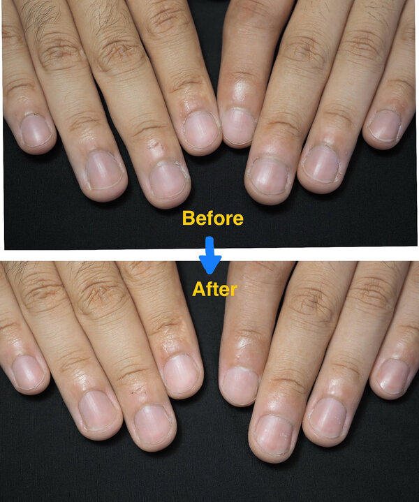 スタイル写真⑧：ネイルケア自爪育成（お試し１回）¥4,400|ネイルサロン Be happy