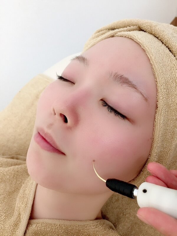 施術の雰囲気|Apple. 宇都宮店【アップル】