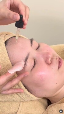 レチノールピール|Apple. 宇都宮店【アップル】