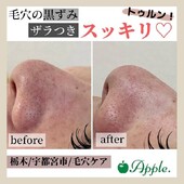 【毛穴ケア】before/after①|Apple. 宇都宮店【アップル】