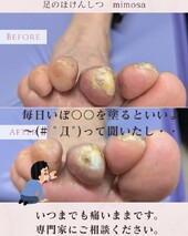 専門家にご相談ください！|足のほけんしつ mimosa