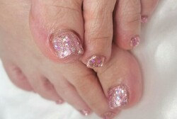 「フット ラメワンカラー+巻き爪ジェル」お爪のカタチや巻き爪、深爪を美しい形へ導きジェルを楽しめます|Nail Salon Linda