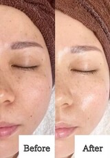 ダイヤモンドコーティングスピキュール【before/after】|Muse factory Beauty【ミューズファクトリービューティー】