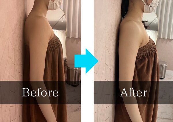 最新機器Dr.Pro「上半身ボディメイク」【before/after】|Muse factory Beauty【ミューズファクトリービューティー】