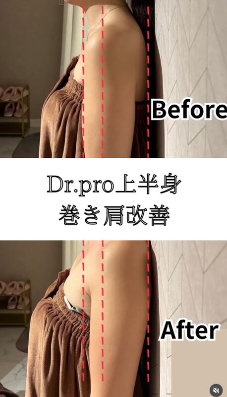 最新機器Dr.Pro「上半身ボディメイク」【before/after】|Muse factory Beauty【ミューズファクトリービューティー】