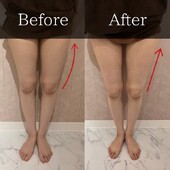 最新機器Dr.Pro「下半身ボディメイク」【before/after】|Muse factory Beauty【ミューズファクトリービューティー】