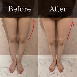 最新機器Dr.Pro「下半身ボディメイク」【before/after】|Muse factory Beauty【ミューズファクトリービューティー】