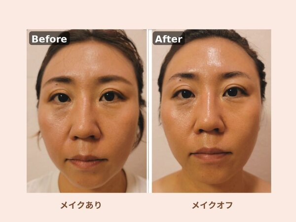 コラーゲン美肌×小顔リフトアップフェイシャル|makeroomPALETTE