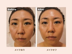 コラーゲン美肌×小顔リフトアップフェイシャル